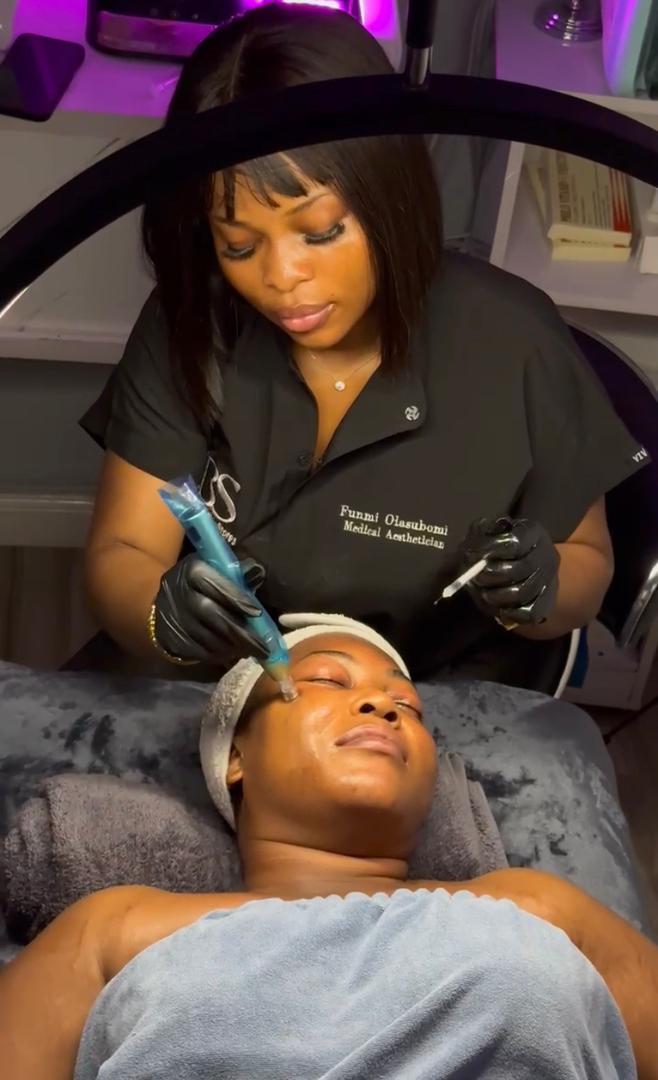 Microneedling
